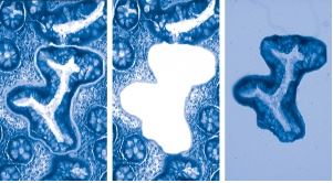 Laser Microdissection