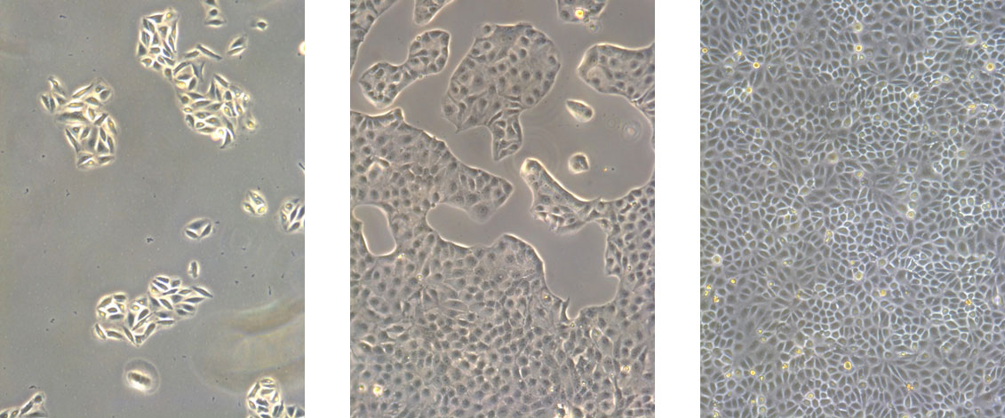 Cell Culture Solutions